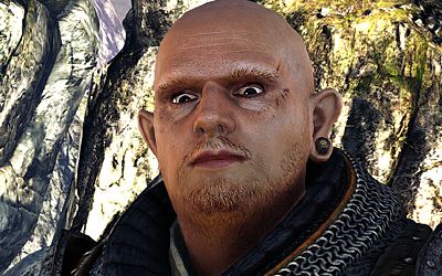 Time heals all things, except these crazy eyes